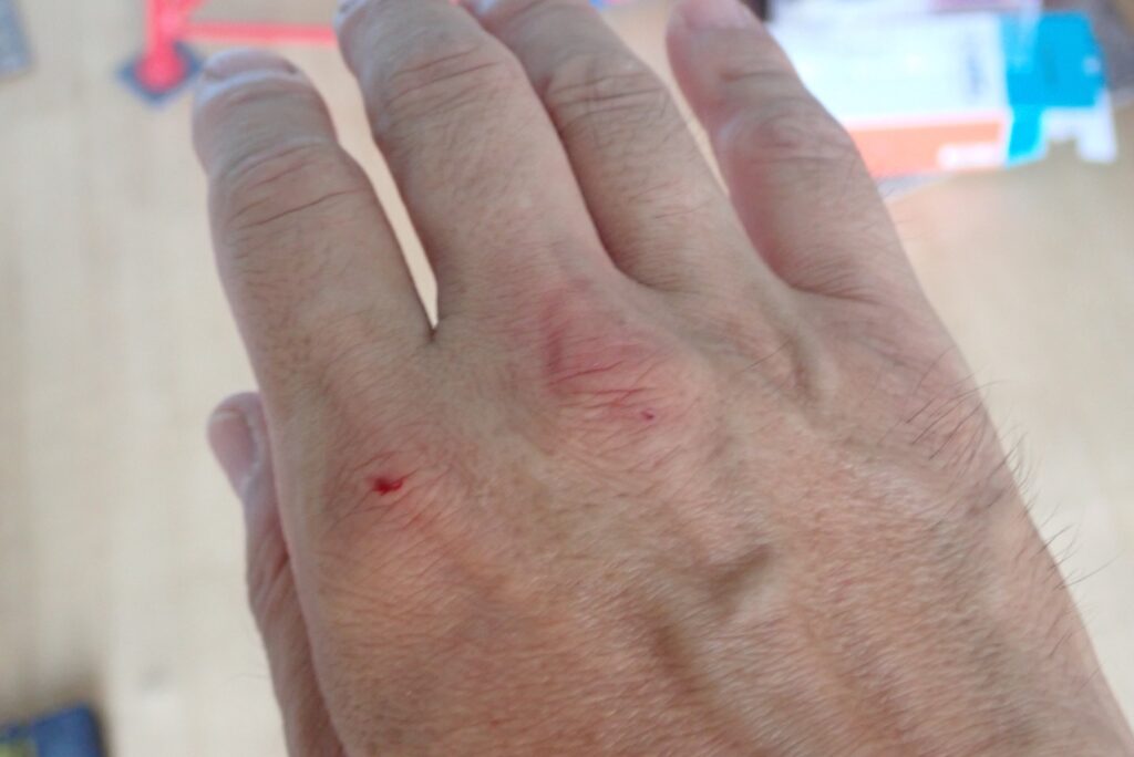 Close-up of cuts and bleeding on a mechanic's hand received while removing motorcycle body panels, emphasizing the need for gloves.